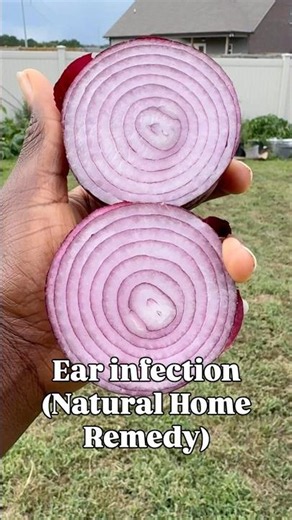 Natural home remedy for ear infection. #healthandwellness