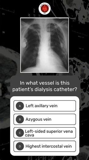 Test Your Diagnostic Skills | Medical Quiz Challenge for MRCP, USMLE & NEET Aspirants