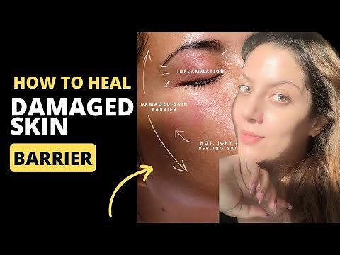 How To Heal Damaged Skin Barrier | How to treat broken skin barrier | Nipun Kapur