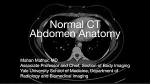 Normal CT Abdomen Anatomy