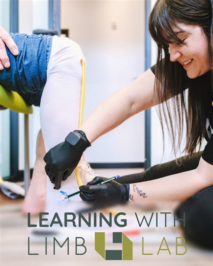 Watch this video to learn how to don (put on) and doff (take off) an elevated vacuum suspension system. 📝 This advanced system uses active vacuum technology to maintain a strong, consistent seal between your residual limb and the prosthesis. Follow these steps for a secure, comfortable fit so you can get back to doing what you love. 🫶 What do you want to do? Click here to learn more! https://tinyurl.com/4fs2zkh2 #Prosthetics #LimbLab #Education | Limb Lab