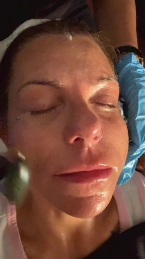 #skin #skincare #facial