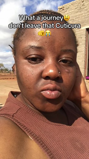 Cuticura Products: Reviews, Prices, and Benefits