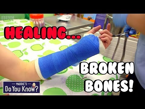 How do you make a Plastic Cast for Broken Bones? 🏥 Maddie's Do You Know? 👩