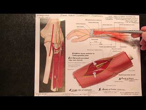 Radial Nerve Compression Syndromes (Radial Tunnel Syndrome/ Wartenberg Syndrome)