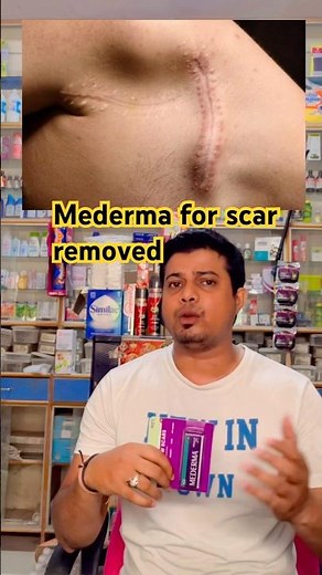 Review for Mederma advanced #gyanitaksh #scarremoval #mederma #skincare