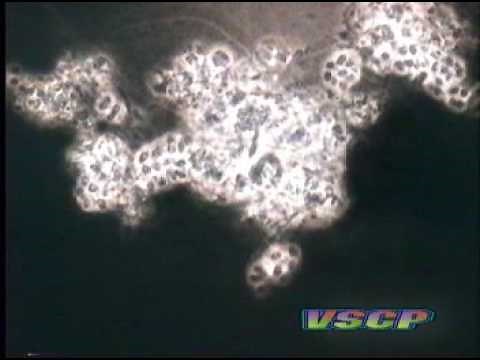 India Ink Stain Procedure