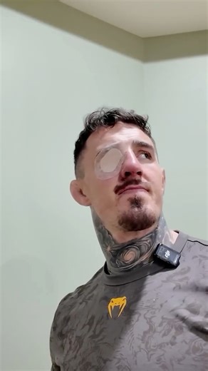Tom Aspinall says this eye injury was 'way scarier' than his knee injury suffered against Curtis Blaydes 😢 Get well soon Tom. Watch the full video on his YouTube now 👉https://youtu.be/JNzOuhrHMUc?si=e1x6B5QplLJiu_kE | TNT Sports