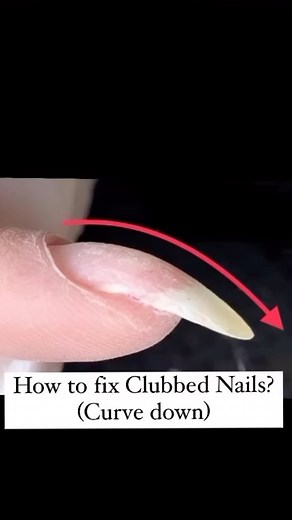 nailsby_hannahbae shares these tips 👉 How to fix Clubbed Nails? Find out where is the highest point of the curve 👉 Credit: Some of the pictures in the video are belong to Tris Le @itstris_nails #nailpro #nailsby_hannahbae #naileducation #naileducator #dallasnails #nailreels #nailvideos #nailtips #nailtipsandtricks #nailtech #nailtrends | Nailpro