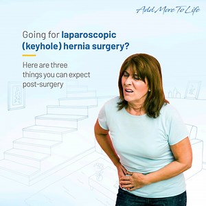 Laparoscopic hernia repair uses a laparoscope – a thin, telescope-like instrument that is inserted through a small incision at the umbilicus (belly button), and therefore the process is called laparoscopic surgery. Long-term outcomes such as recurrence rates using this method are yet unexplained. However, a hernia can reoccur even after the surgery. Therefore, patients are advised to follow precautions and adopt a healthy lifestyle post hernia surgery. #laparoscopic #laparoscopicSurgery #HerniaS