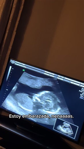 ESTOY EMBARAZADAAAA NENAAAAAS 😭🤰🏻 ¡SÍ, ESCUCHARON BIEN! Diosito me mandó otra bendición cuando menos me lo esperaba. 🥹🙏🏻 Aquí andamos, siendo mamá de dos bendiciones y ahora con otro bebé en camino. 😭❤️ ¡Acompáñenme en esta nueva etapa de mi vida porque se viene el chisme completo! JAJAJA 😂🤰🏻 #EstoyEmbarazada #StoryTime #MamáDeTres #BendiciónDeDios #Embarazo