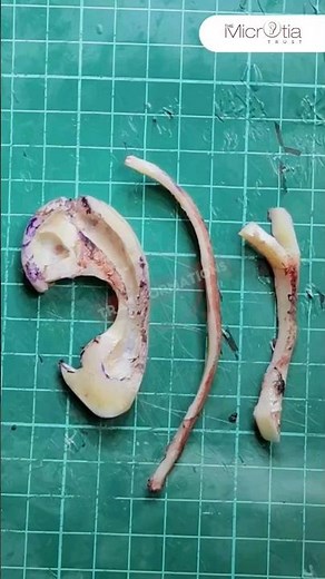 Rib Cartilage Framework for Ear Reconstruction Surgery | #earconstruction #Shorts #youtubeshorts