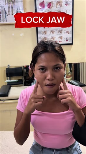 Paano Naibalik ang Lock Jaw sa 3 Araw