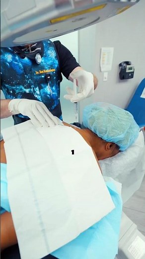 Watch a Cervical Epidural Steroid Injection (CESI) 💉#MedicalProcedure #SpineCare