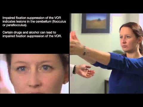Visual Fixation Suppression of the VOR