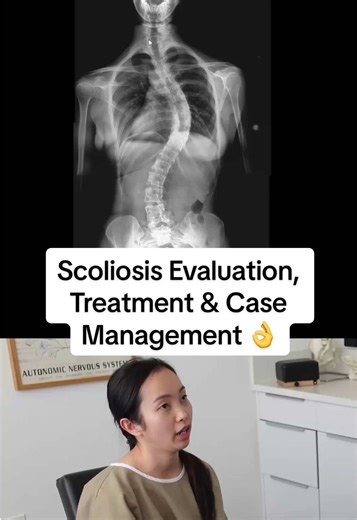 Scoliosis Treatment with Gonstead Chiropractic Techniques