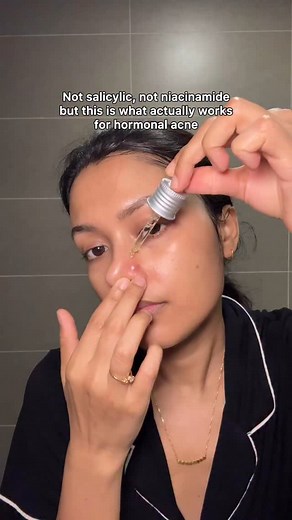 49K views · 103 reactions | Hormonal acne is painful but thankfully I...
