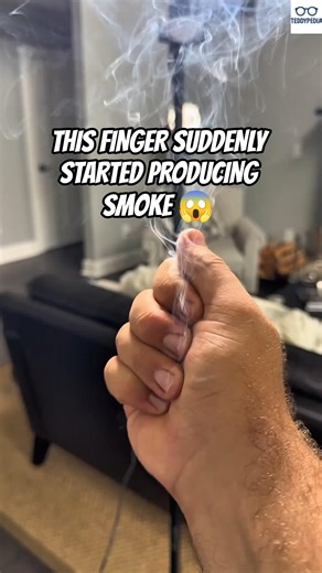THIS FINGER SUDDENLY STARTED PRODUCING SMOKE 😱