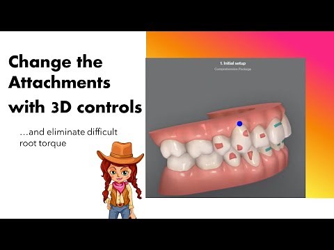 Invisalign ClinCheck - Changing attachments with 3D controls