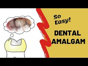 Dental Amalgam | Incredibly Easy!