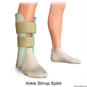 铸造和夹板 - 疾病 2026
