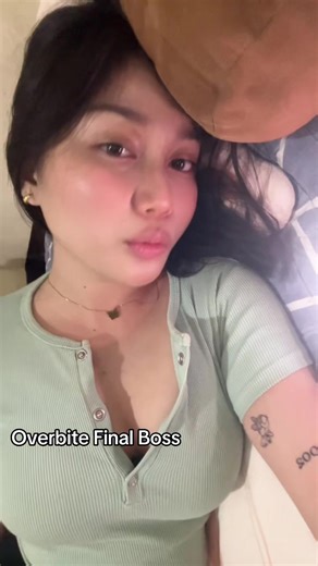 Understanding Overbites: Causes and Solutions