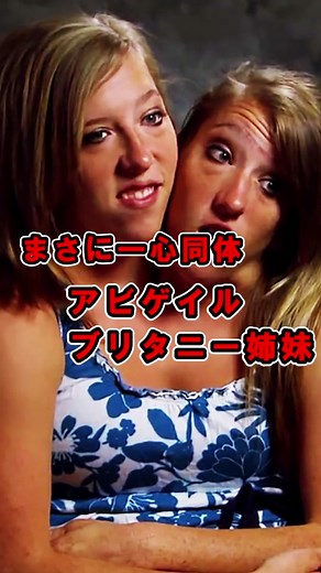 一心同体！アビゲイル・ブリタニー姉妹の驚くべき物語