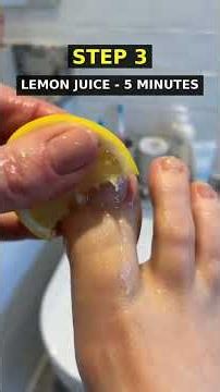 Yellow Toenails? This 5-Step Home Remedy Brightens Them in 7 Days! #shorts