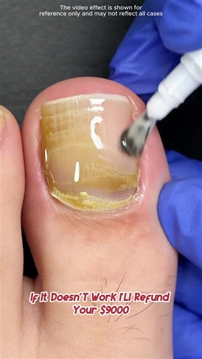 Antibacterial Nail Polish for Long-Lasting Shine