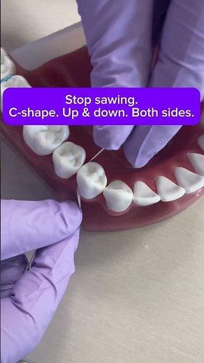 C-shape flossing.Slow. Gentle. No pain. #flossingtips #dentalhygiene #healthygums