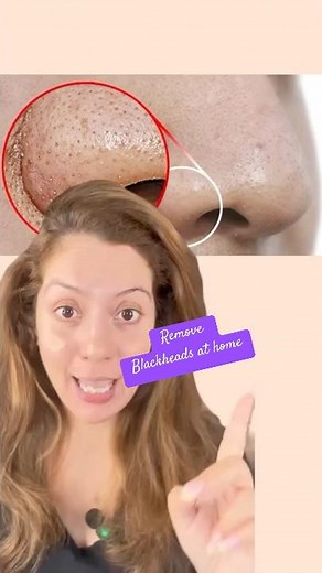 How to Do a Clean Up at Home | Remove Blackheads Like a Pro | Nipun Kapur