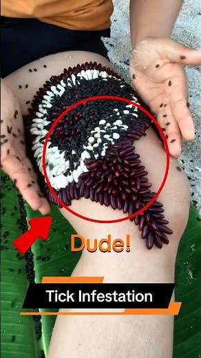 Tick Infestation 😱🕷️ (This Is Worse Than You Think) #facts