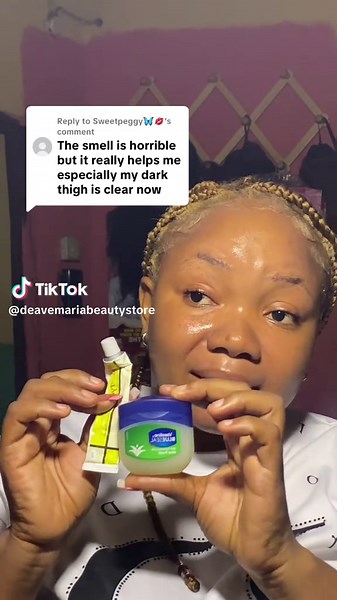 Vaseline and Aloe Vera for Stretch Marks Solutions