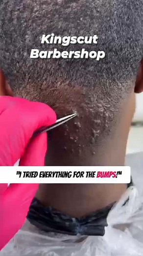 Weekend is here with us! Treatment sessions ongoing! Book yours now. Call/ Text on 0759805634. Location- Clarret, off Roasters and along Garden Estate Road, Nairobi. | Kingscut Barbershop