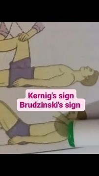 Wierd way to remember Kernig's and Brudzinski's sign in Meningitis | Medicine | Neurology |MBBS FCPS