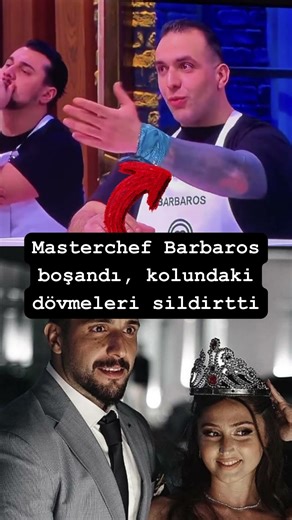 MASTERCHEF BARBAROS KOLUNDAKİ DÖVMELERİ SİLDİRDİ
