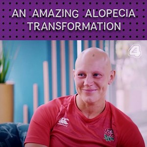 This rugby player transformation will make you cry... | E4