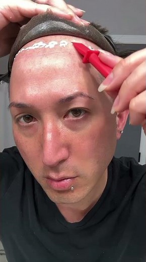 🔥Die bewährte Lösung gegen Haarausfall: Hochwertige Haarsysteme für Männer #haarausfall #glatze