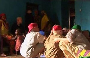 Albinos en peligro de extinción