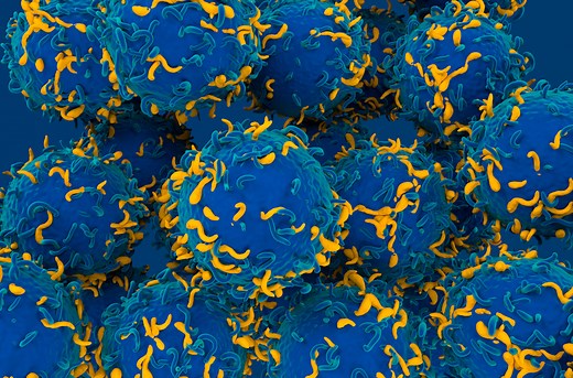 Scientists Discover a Cause of Lupus and a Possible Way to Reverse It - News Center