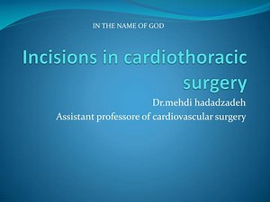 Incisions in cardiothoracic surgery - SlideServe