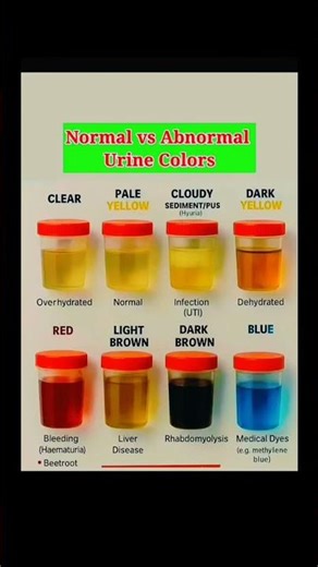 Urine Color Meaning | What Your Pee Says About Your Health | Medical Animation #shorts #viral