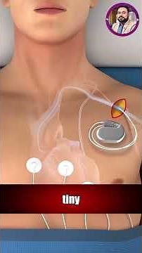 How a Pacemaker Works in 3D Animation ❤️ #Pacemake #Shorts #Doctor