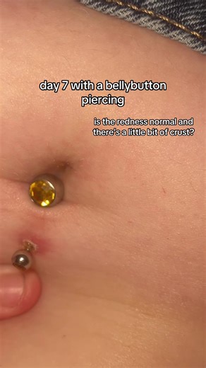 Belly Button Piercing Healing: Day 7 Update