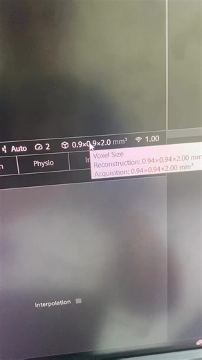 57K views · 692 reactions | Tại console máy siemen, chọn tap resolution thẻ common chọn interpolation pixel giảm ngay một nửa. Bạn đã biết chưa? | MRI Việt Sub | Facebook