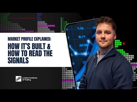 Market Profile Explained: How It’s Built & How to Read the Signals