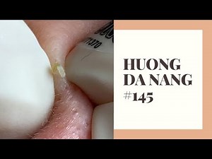 #145 | Huong Da Nang