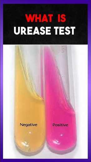 Urease Test | Clear Explain