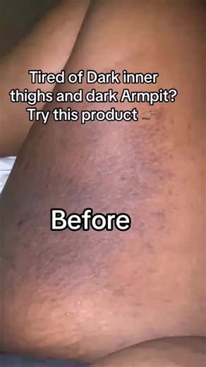 ‏Evens your Skin Tone within 7 days ✨ Last pieces in stock #curaglow