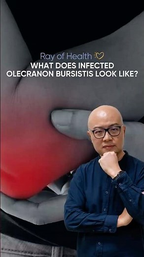 What Does Infected Olecranon Bursitis Look Like?